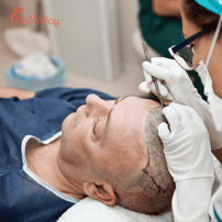 Hair Transplants in Turkey: Affordable Solutions for Canadians Seeking Hair Restoration